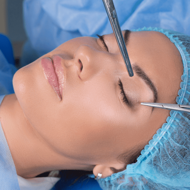 eyelid loan options